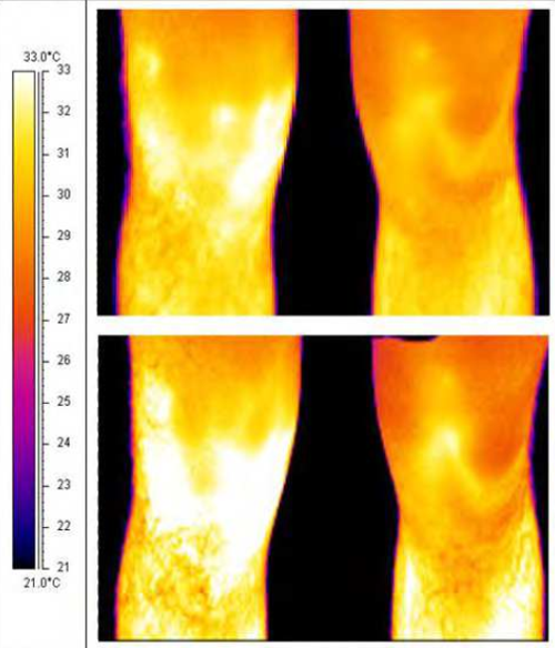 运动员比赛前后左右膝盖的红外热成像